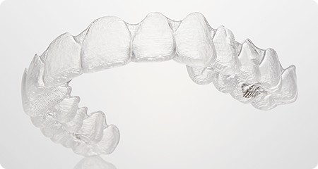 マウスピース矯正（インビザライン等）